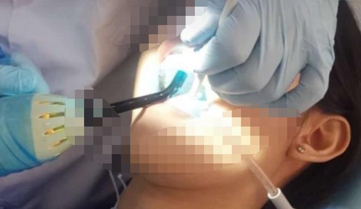 宜春振兴口腔医院做牙齿修复好吗？医院介绍附案例价格表！(图2)