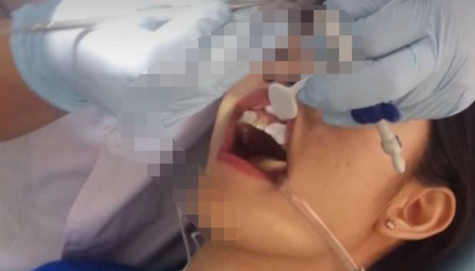 宜春振兴口腔医院做牙齿修复好吗？医院介绍附案例价格表！(图3)