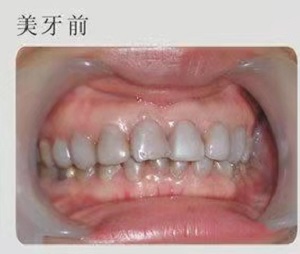 优诺博士口腔医院怎么样？内含价格表及案例分析(图2)