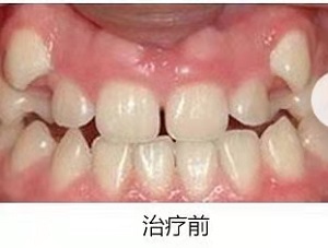 优诺博士口腔医院口碑好不好？内含价格表及案例分析(图2)