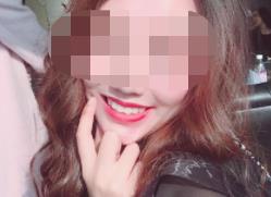 永川口腔医院洗牙效果好不好？医院介绍附案例和价格表！(图2)