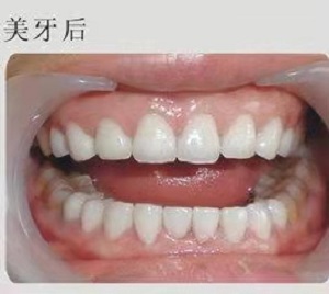 鄞州儿童口腔医院怎么样？内含价格表及案例分析(图3)
