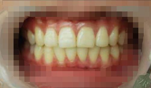 杨桥路口腔医院好吗？能做牙齿美白吗？医院介绍附案例和价格表！(图2)