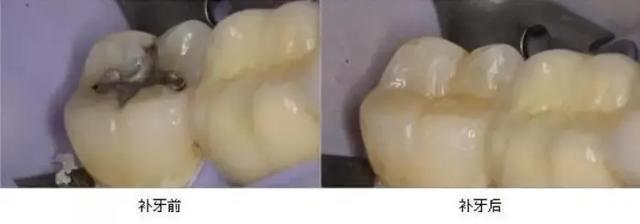 牙花肿疼怎么办(牙花子肿疼怎么办)