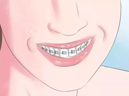 牙线棒怎么用;细滑牙线棒怎么用