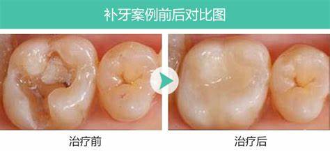 牙齿酸痛该怎么办;牙齿酸痛该怎么办缓解