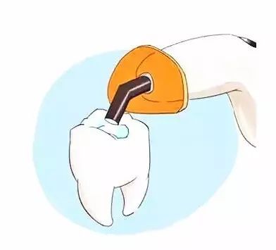 牙石怎么去除—牙石怎么去除较简单的方法(图2)