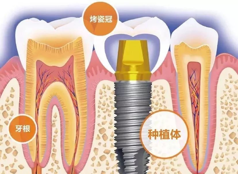 可恩口腔医院怎么样_淄博可恩口腔医院怎么样(图2)