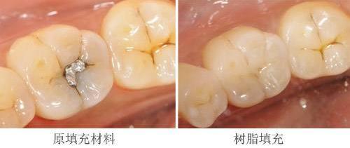 牙齿酸怎么办，酸的吃多了牙齿酸怎么办(图3)