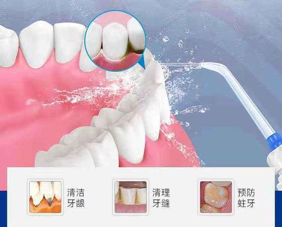 牙菌斑怎么去除;牙齿长牙菌斑怎么去除(图3)