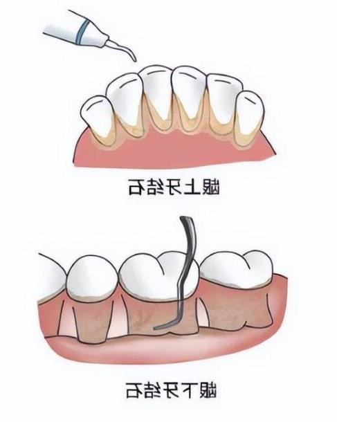 珠海口腔医院评价及价格指南