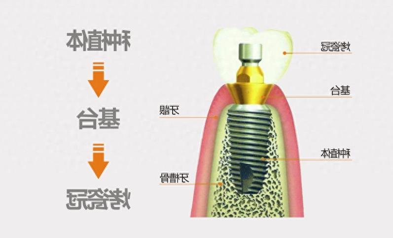 南京地区种植牙医院全新排名及特色介绍(图2)