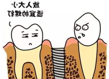 根管治疗费用解析：价格构成与牙冠价格指南(图2)