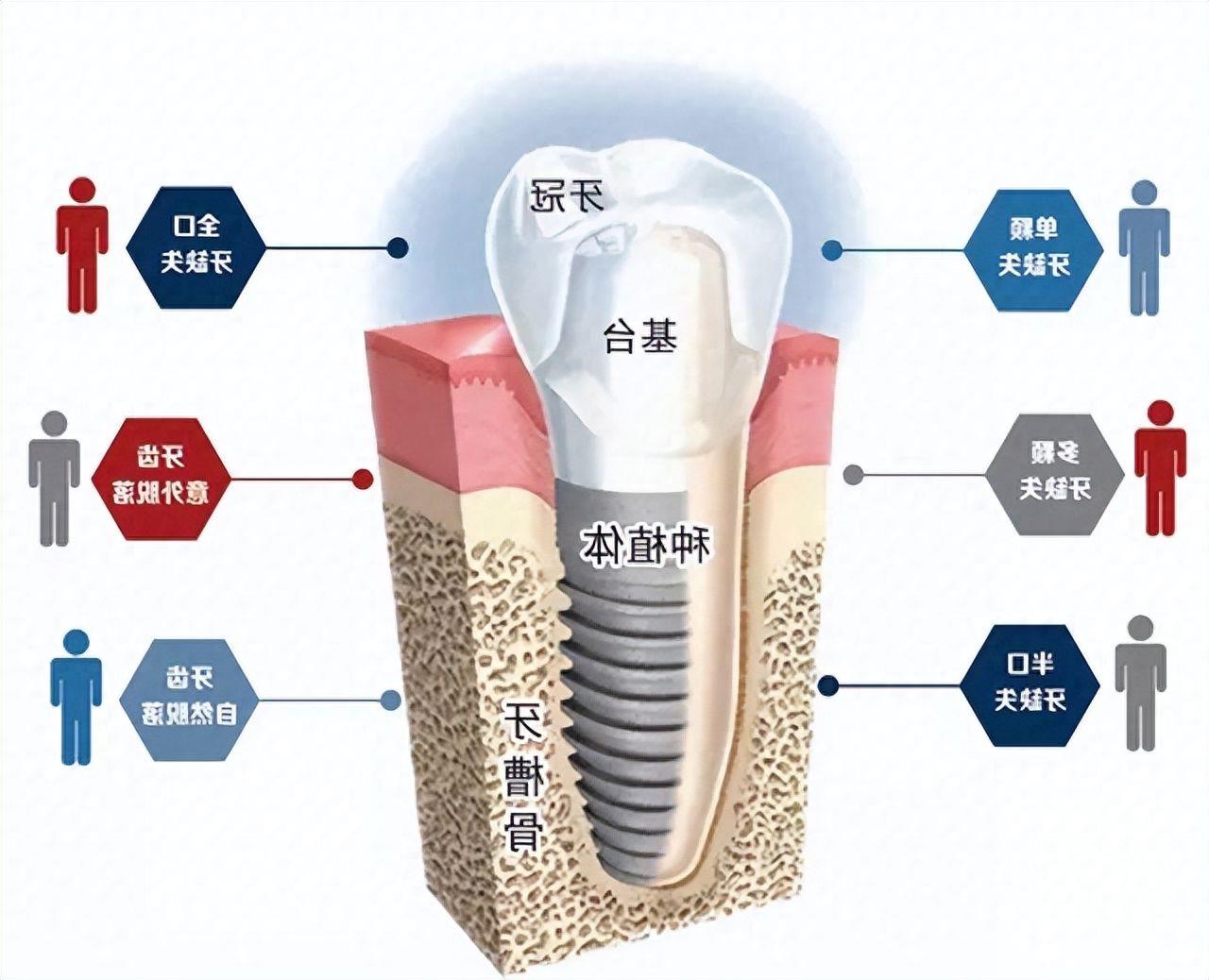 临汾麦特登口腔隐形矫正：技术精湛，服务周到，价格亲民(图2)