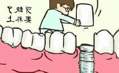 彭埠区种植牙医院推荐：性价比与正规性并重(图1)