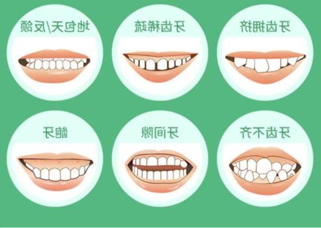 广州中家医家庭医生口腔种植牙技术全新解读及价格指南(图1)