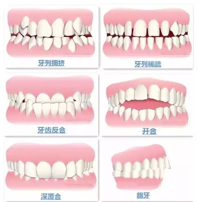 清远牙齿矫正医院推荐：专业医师与合理价格的好结合(图1)