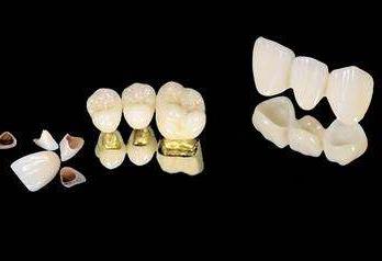 兰州种植牙技术哪家强？口腔医院排名大揭秘(图1)
